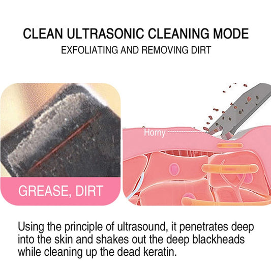 Ultrasonic Atomizing Skin Scrubber Blackhead Acne Remover Heating Deep Cleansing Facial Peeling Shovel Face Clean Skin Care(DYM-013)