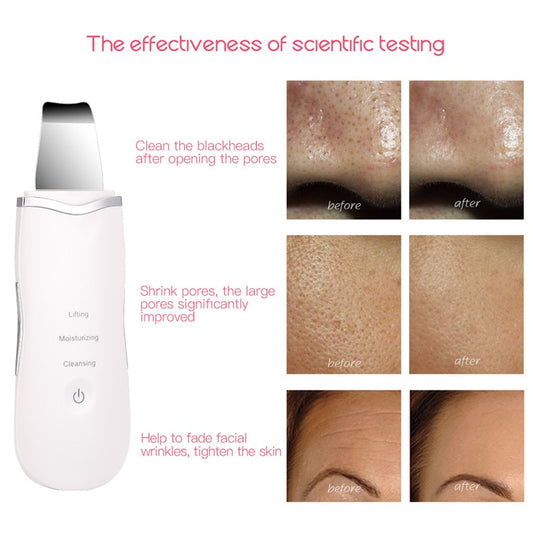 Professional Ultrasonic Facial Skin Scrubber Ion Deep Face Cleaning Peeling Rechargeable Skin Care Device Beauty Instrument 42
